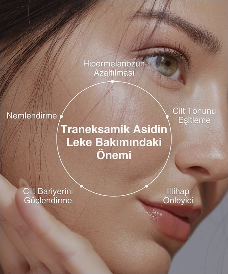 Me Line Leke Bakımı