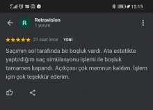 Saç simülasyonu işlemi ile boşluk tamamen kapandı